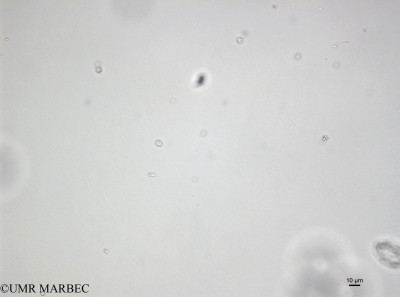 phyto/Bizerte/bizerte_bay/RISCO April 2014/Phaeocystis sp (Microflagellé 17 - Microflagellé spp <10µm -141218_001_ovl -9)(copy)_thumb.jpg